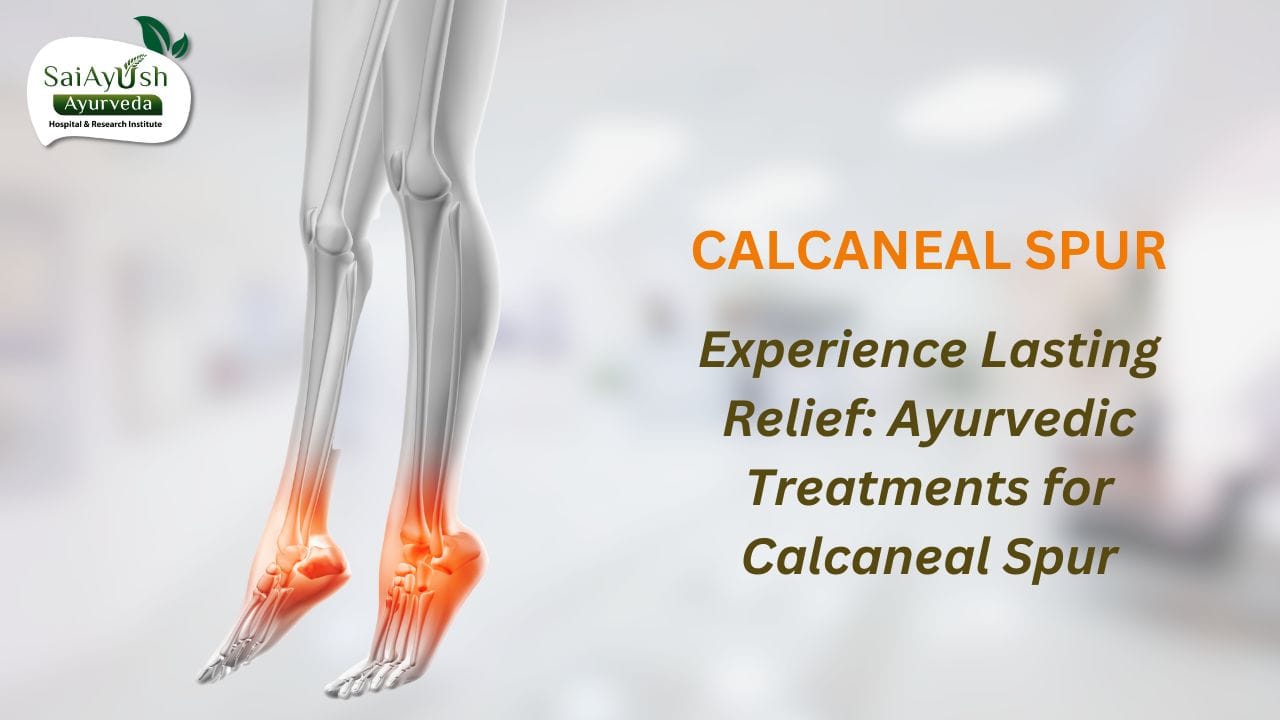 Understanding Calcaneal Spur in Ayurveda: Causes, Symptoms, and Effective Treatment