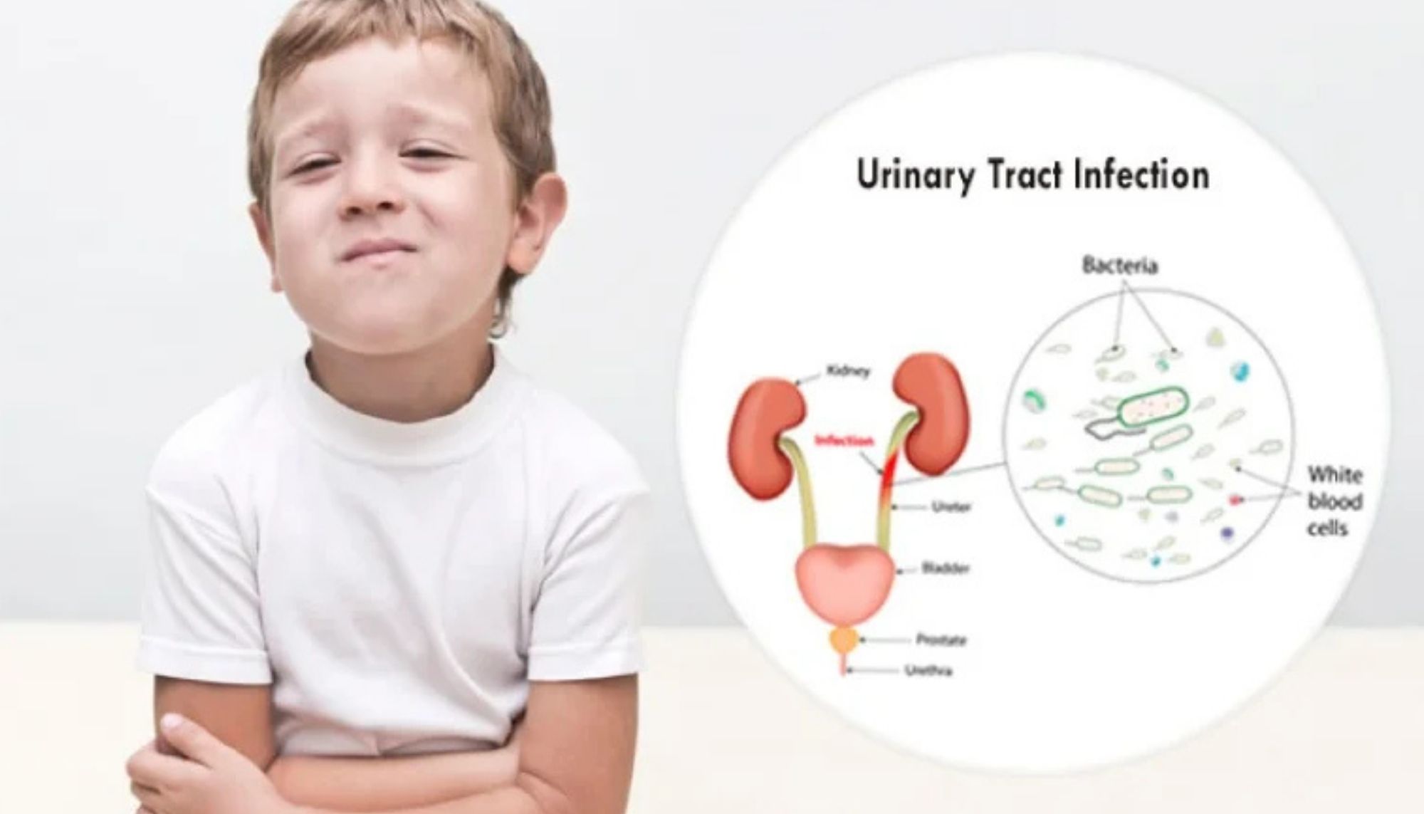 UTI in Children