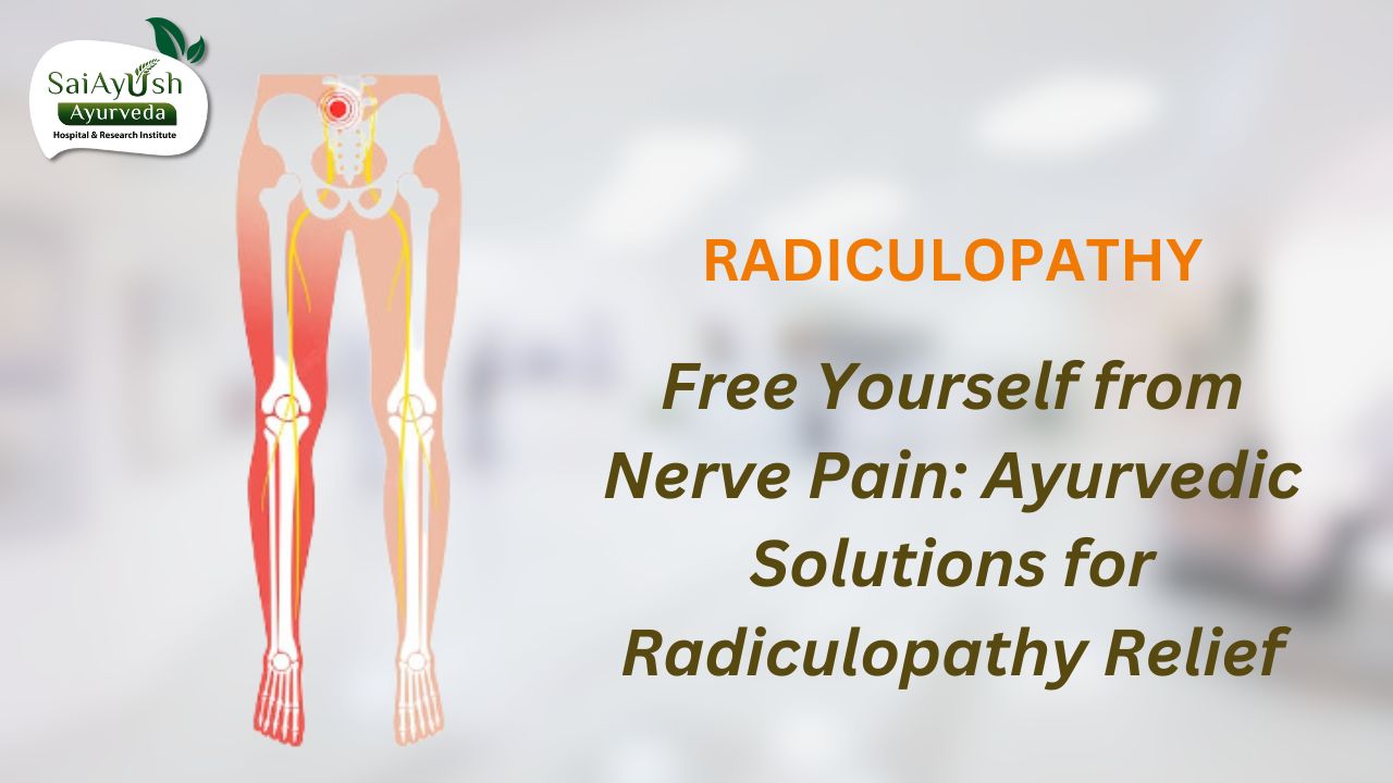 Radiculopathy