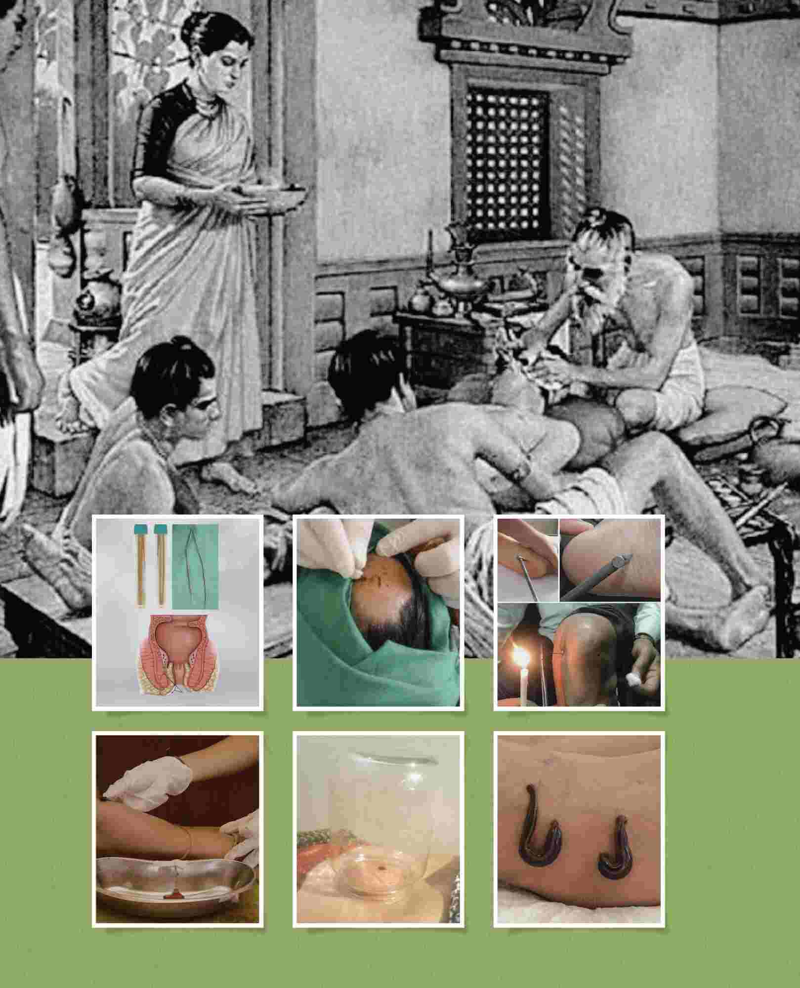 Shalya Tantra Surgical Sai Ayush Ayurveda