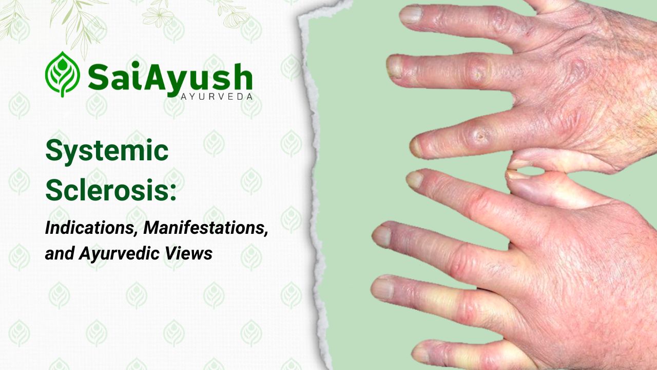 Systemic Sclerosis: Indications, Manifestations, and Ayurvedic Views