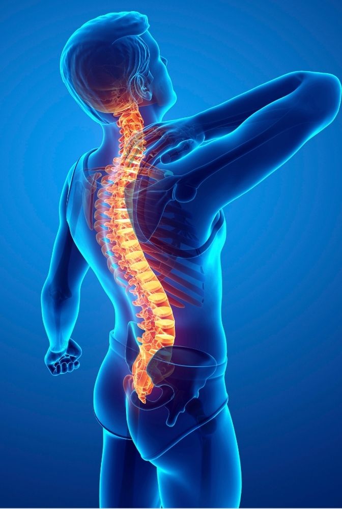 Lumbar Spondylosis 3