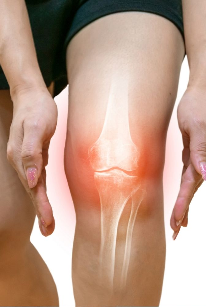 Osteoarthritis 1